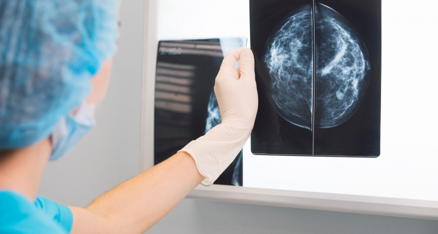 Cáncer de mama: en Argentina se diagnostican más de 22.000 nuevos casos y hay más de 5.000 muertes por año